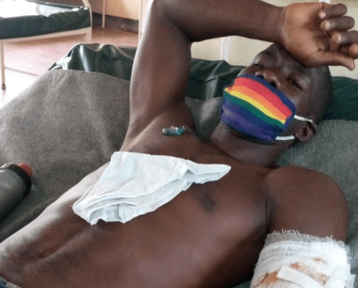 LGBTI+- vluchteling met verwondingen in een vluchtelingenkamp in Kenia